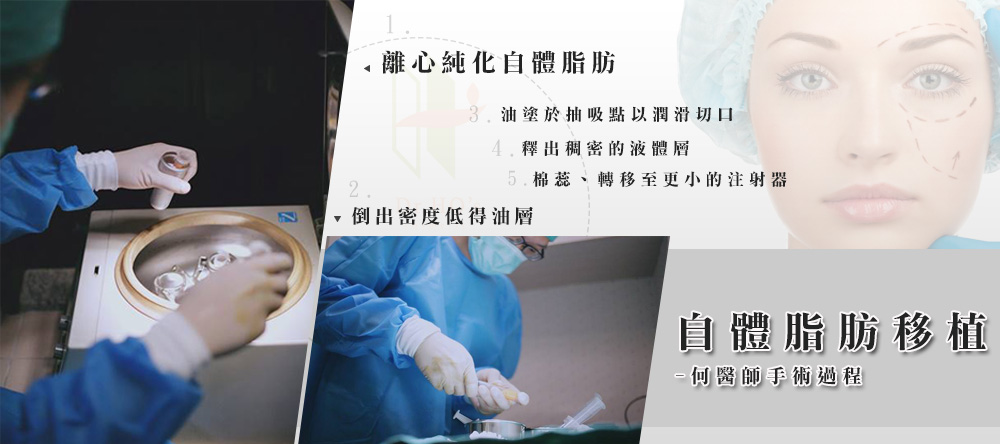 自體脂肪補臉