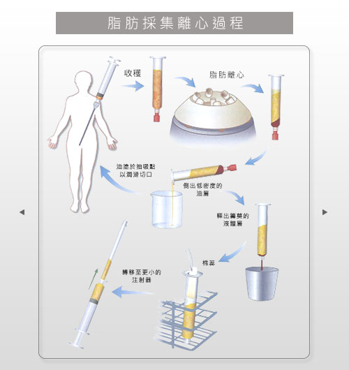 脂肪離心過程